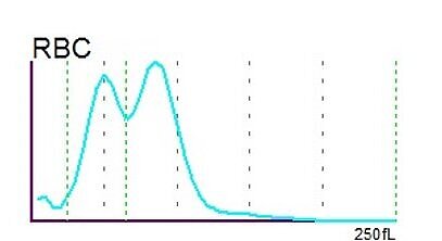 RBC histogram
