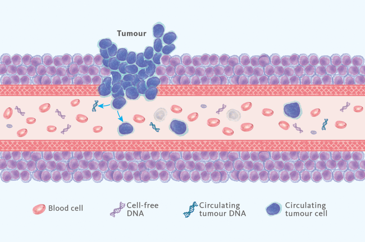 [MEA.COM-en MEA (english)] Liquid biopsy