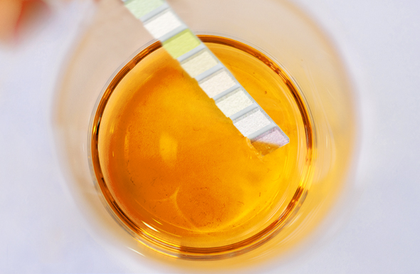 UTI - Diagnosis The first step in diagnosing a UTI is typically a simple urinalysis test, done using a urine sample. I