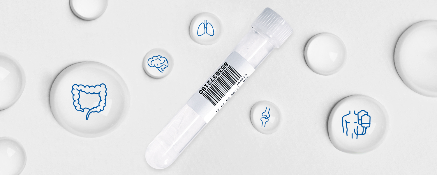 Integrate body fluid cell analysis